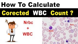 Corrected WBC Count  Clear Explain [upl. by Anivol]