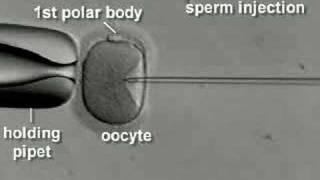 IVF amp ICSI brief overview [upl. by Ynatirb300]