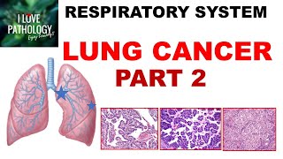 LUNG CANCER  Part 2 Morphology Clinical features [upl. by Sabsay486]