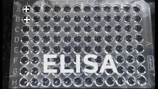 ELISA  How to do ELISA  step by step procedure for ELISA [upl. by Pavior635]