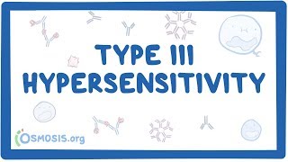 Type III hypersensitivity immune complex mediated  causes symptoms amp pathology [upl. by Holloway675]