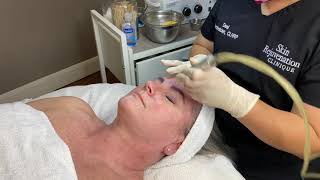 Microdermabrasion Facial Demonstration [upl. by Lednam]