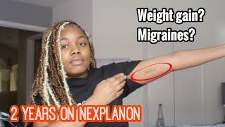 NEXPLANON IMPLANT 2YEAR REVIEW  SIDE AFFECTS CYCLES amp REMOVAL [upl. by Neztnaj]