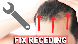 5 POWERFUL Receding Hairline TRICKS to INSTANTLY Improve Your Look [upl. by Ozan]