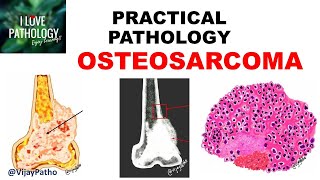 Approach To Lymph Node Pathology Part 1 [upl. by Nyrmac968]