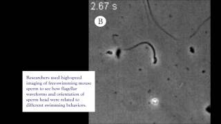 Human Sperm under the microscope [upl. by Kamin]