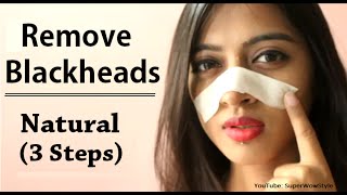 How to Remove Blackheads From Nose amp Face  Naturally at Home  Superwowstyle [upl. by Nalani616]