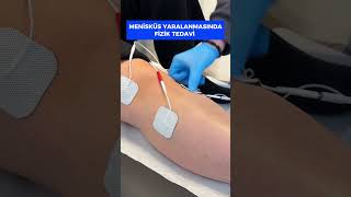 Menisküs Yaralanmasında Fizik Tedavi [upl. by Syah]