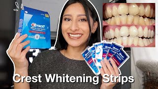 I TRIED THE CREST 3D WHITESTRIPS FOR 14 DAYS Effective  Before amp After pictures [upl. by Ahtreb518]