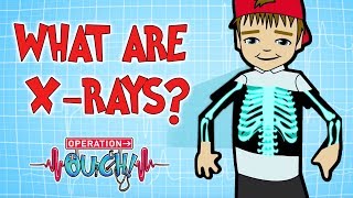 How do XRays Work  Broken Bones  Operation Ouch [upl. by Nibroc]