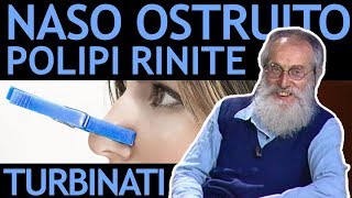 Dott Mozzi Naso ostruito polipi nasali turbinati rinite sinusite [upl. by Ttihw]