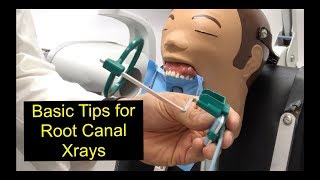 Basic Tips for Root Canal Xrays [upl. by Ttimme346]