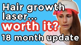 iRestore hair growth laser 18 month update Is it worth it Dr Dray [upl. by Grier]