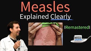 Measles Symptoms Diagnosis Vaccine Treatment Explained [upl. by Dodd]