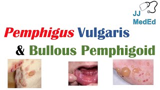 Vesiculobullous Skin Diseases  Pemphigus Vulgaris vs Bullous Pemphigoid [upl. by Assirrec]