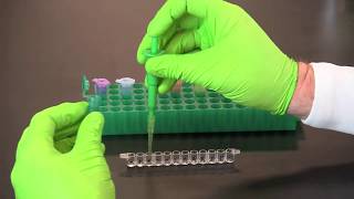 How To Perform A Qualitative ELISA [upl. by Stephan]