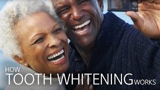 How Tooth Whitening Works [upl. by Conlee]