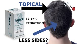 Topical Finasteride Science Pros and Cons and Practical Tips [upl. by Mars]