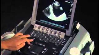 How To Ultrasound FAST Exam  Male Pelvis [upl. by Andaira]