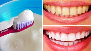 10 Natural Ways to Whiten Teeth at Home [upl. by Nyrek579]