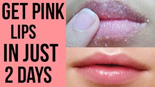 How to get pink lips Lighten dark lips naturally at home Get Rid Of Chapped Lips [upl. by Setsero]