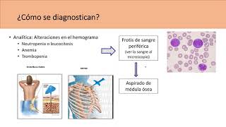 Leucemia  Qué es tipos y síntomas [upl. by Lannie]