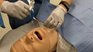 Surgical tracheostomy procedure [upl. by Chew]