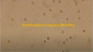 Burkholderia cepacia Motility [upl. by Nancey908]