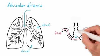 Airway disease versus alveolar disease [upl. by Silverstein]