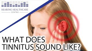 What Does Tinnitus Sound Like [upl. by Rausch]