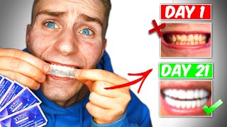 Crest 3D White Strips Do They Work 21 day challenge [upl. by Engelbert175]