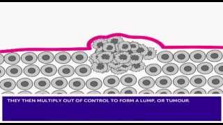 How Cancer Develops amp Mutation [upl. by Giorgia]