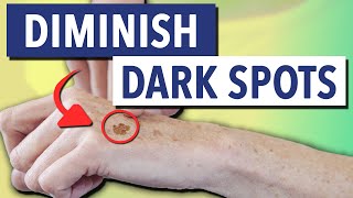 What Makes Gundry MD Dark Spot Diminisher Different [upl. by Nassir]