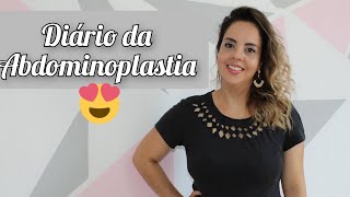 Abdominoplastia ❤️ PRIMEIRA CONSULTA COM VALORES ❤️ Cirurgia Plástica 1 [upl. by Fu]