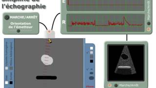 EVALUATION OF MITRAL VALVE AT TRANSESOPHAGEAL ECHOCARDIOGRAPHY TEE [upl. by Penn]