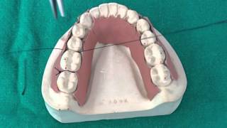 Peridontal Suturing Techniques [upl. by Imoyn]