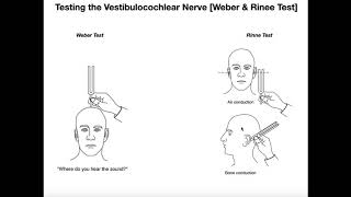 Interpreting the WeberRinne Tests EXPLAINED [upl. by Novihs]