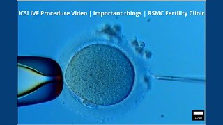 ICSI IVF Procedure Video  Important things  RSMC Fertility Clinic [upl. by Inava]