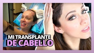 MI TRANSPLANTE DE CABELLO  HAIR TRANSPLANT SURGERY  RosyStoryTime [upl. by Gnap]