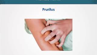 Pruritus  Dermatology  EduRx [upl. by Ettennod133]