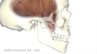 What causes muscle spasm near TMJ  Dr Arundati Krishnaraj [upl. by Alletneuq]