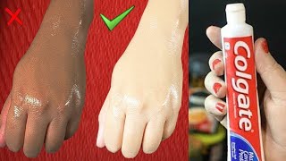 Skin Whitening Colgate Toothpaste At Home Remedies  Lifestyle Tips [upl. by Gerald473]