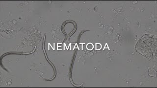 Nematodes [upl. by Ahsinal]