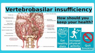 The vertebrobasilar system [upl. by Moyra]