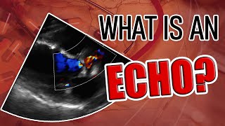 Echocardiography Diastolic Dysfunction Measurement with Demonstration [upl. by Brice]