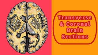 Transverse and Coronal Brain Sections [upl. by Nylteak841]