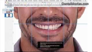 DSD  Digital Smile Design by Felipe Miguel [upl. by Edyaw]