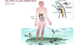 Ultrasound of Common Adnexal Cysts [upl. by Ja]