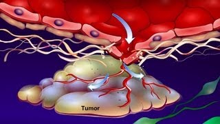 Introduction to Cancer Biology Part 4 Angiogenesis [upl. by Dranal]