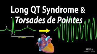 Long QT Syndrome and Torsades de Pointes Animation [upl. by Aikam]